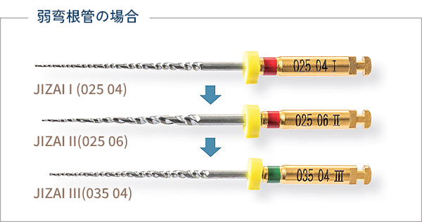 弱弯根管の場合