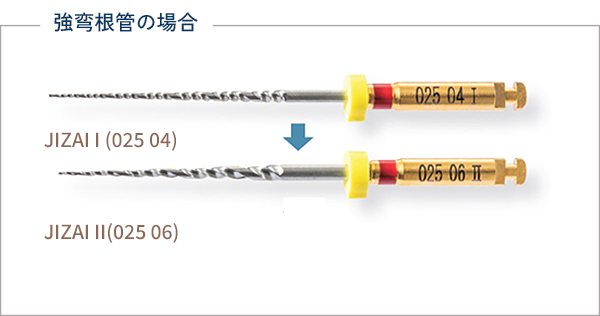 強弯根管の場合