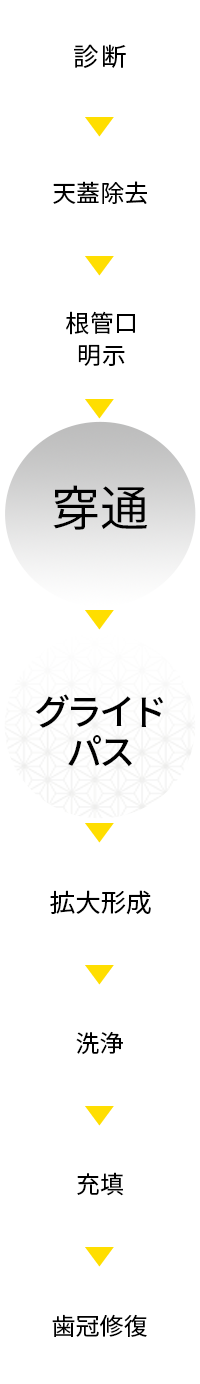 診断から歯冠修復までのフロー